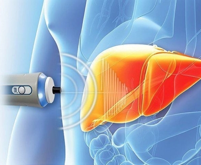 Các cách phát hiện sớm ung thư gan